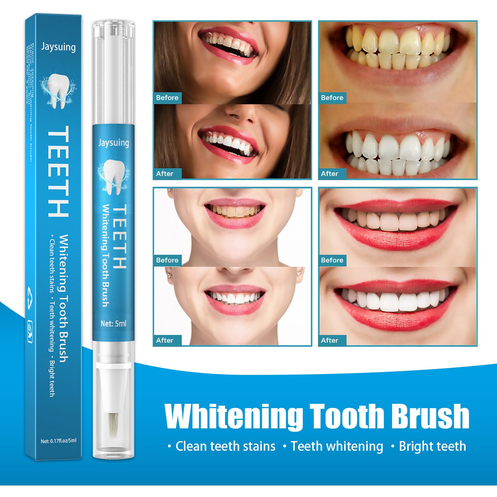 Jaysuing BrightSmile Teeth Whitening Pen – Instant Stain Removal & Shine Booster